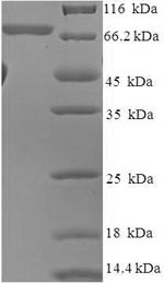 RAC-beta serine/threonine-protein kinase (AKT2), human, recombinant