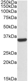 Anti-Calponin 2 / CNN2, Internal