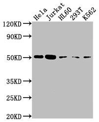 Anti-CASP2 Recombinant Monoclonal, clone 7E5