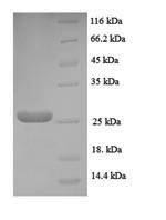 Neuritin (NRN1), human, recombinant