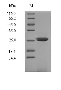 Interleukin-7 receptor subunit alpha (Il7r), partial, mouse, recombinant