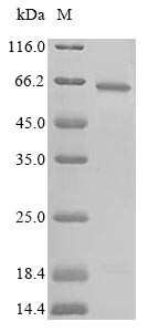 Cystathionine beta-synthase (CBS), partial, human, recombinant
