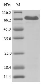 NACHT, LRR and PYD domains-containing protein 3 (NLRP3),partial, human, recombinant