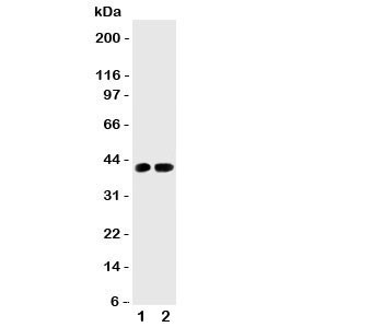 Anti-Cdk6