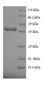 Dual specificity protein phosphatase 26 (DUSP26), human, recombinant