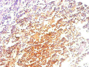 Anti-B2M Monoclonal, clone 2D3E5