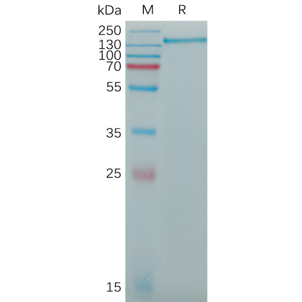 Human CD163 Protein, His Tag