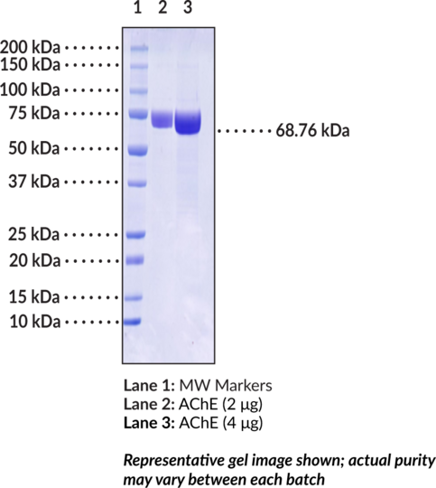 Acetylcholinesterase (human, recombinant)