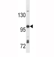 Anti-TLR7