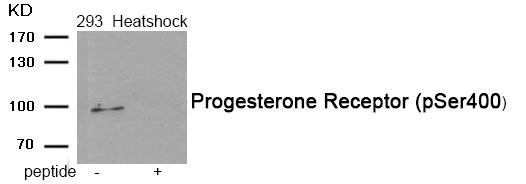 Anti-Phospho-PGR (Ser400)