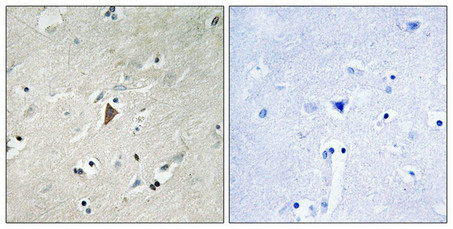 Anti-Phospho-PDPK1 (Tyr9)