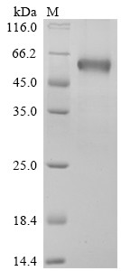 B- and T-lymphocyte attenuator (BTLA), partial, Biotinylated, human, recombinant