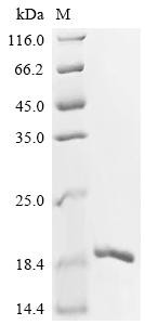 Apoptosis-associated speck-like protein containing a CARD (PYCARD), Partial, human, recombinant