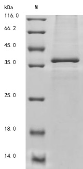 Deoxyribonuclease gamma (DNASE1L3), human, recombinant