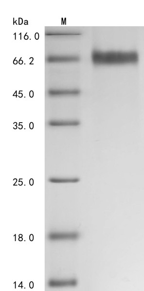 Tyrosine-protein kinase receptor UFO (AXL), partial, human, recombinant