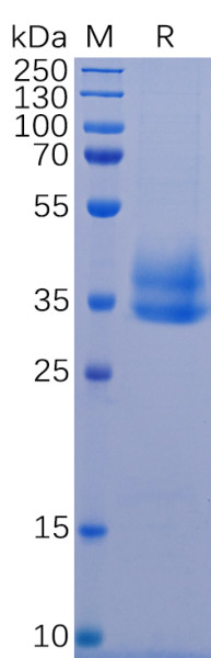Human IL2RB Protein, His Tag