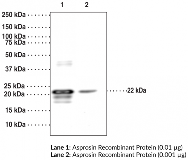 Anti-Asprosin