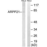 Anti-ARPP21