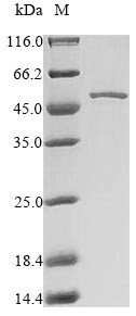 Induced myeloid leukemia cell differentiation protein Mcl-1 homolog (Mcl1), partial, mouse, recombin