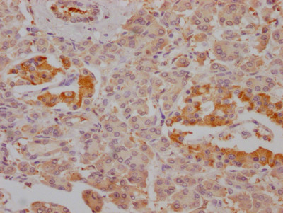 Anti-FBP1 Recombinant Monoclonal, clone 4G3