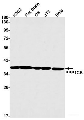 Anti-Recombinant PP1C beta, clone R09-6B7