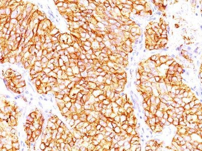 Anti-Renal Cell Carcinoma (Carbonic Anhydrase IX)(66.4.C2), Biotin conjugate, 0.1mg/mL