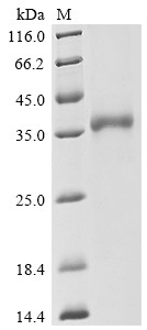 Novel Coronavirus Spike glycoprotein (S), partial, Biotinylated, human, recombinant