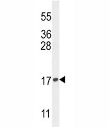 Anti-Histone H3.3 (H3F3A)